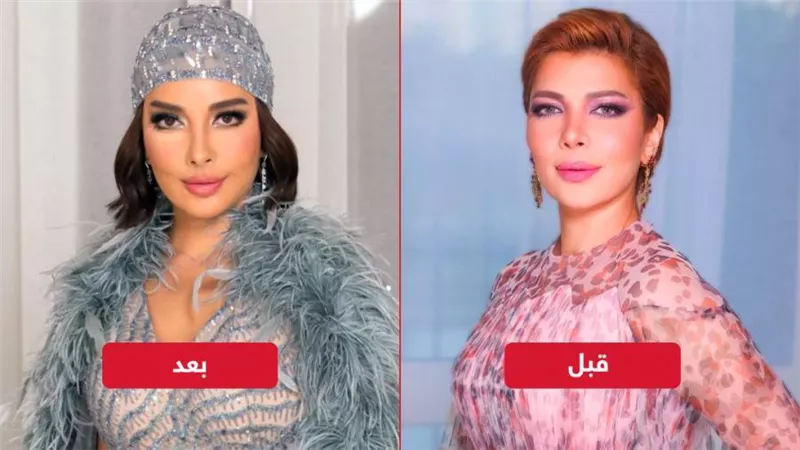 فيلر وبوتكس وتكساس ستايل .. ماذا فعلت أصالة في وجهها ؟ 